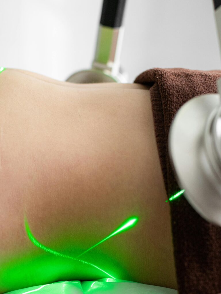 Close-up of a laser liposuction treatment in a contemporary clinic setting, emphasizing precision.